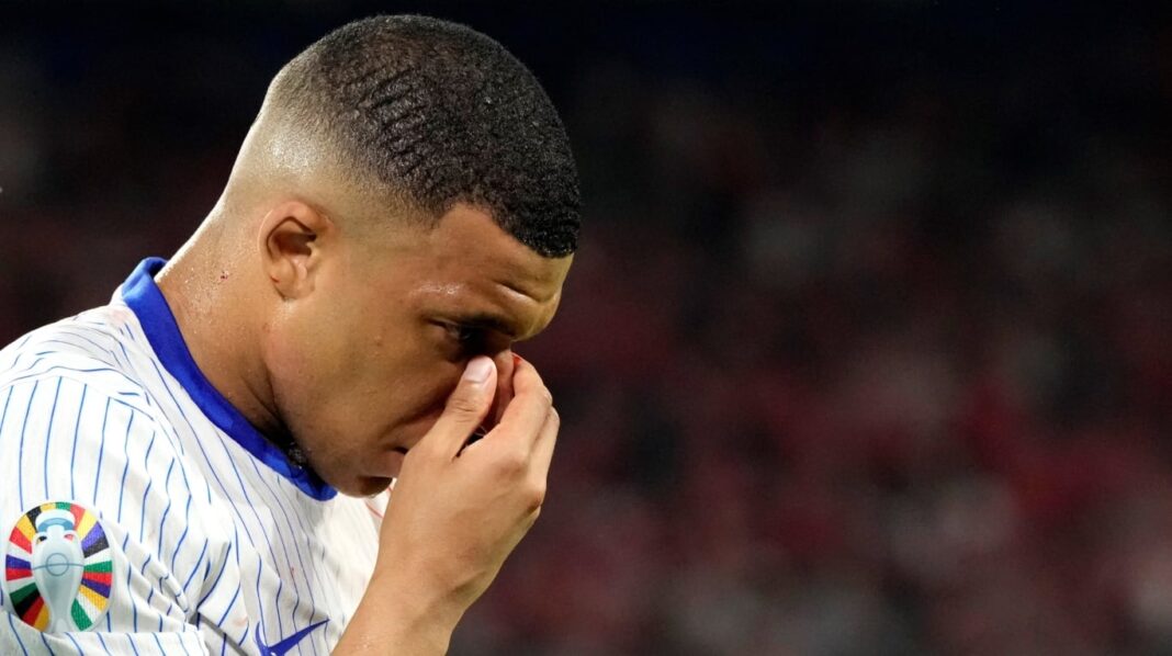 asi-le-quedo-la-cara-a-kylian-mbappe-tras-la-fractura-de-nariz-que-sufrio-en-la-eurocopa