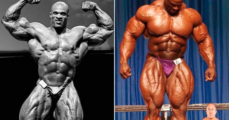 El impactante cambio muscular en las piernas del legendario fisicoculturista Ronnie Coleman tras pasar por más de 15 cirugías