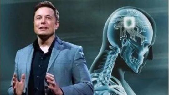 Neuralink proyecta 20.000 implantes cerebrales por año para 2031: Musk promete tratar el Parkinson y la ceguera