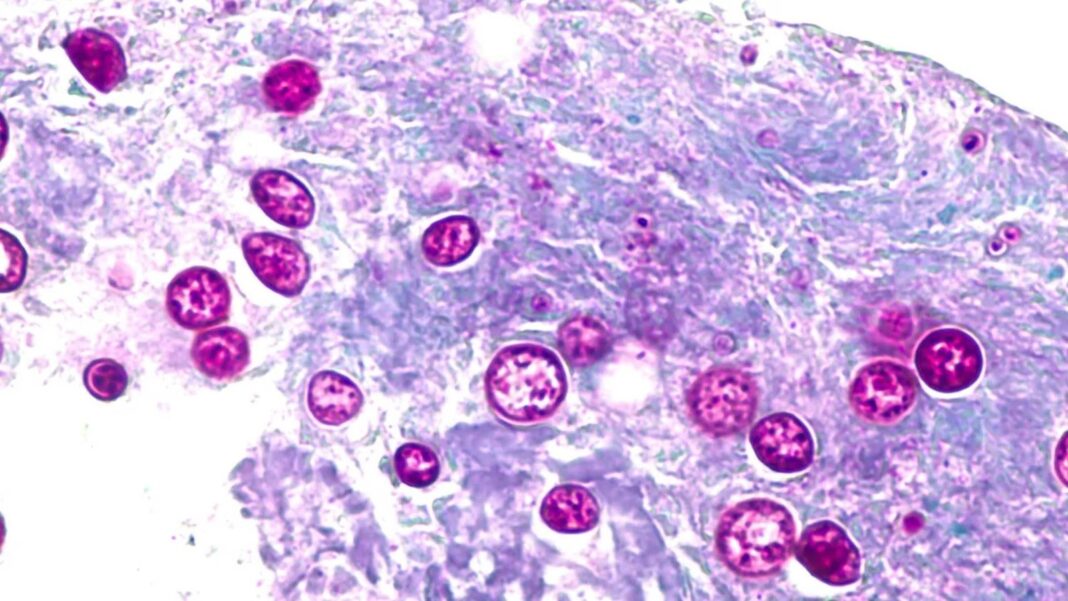 Microscopía del parásito Cyclospora cayetanensis asociado a brotes de ciclosporiasis